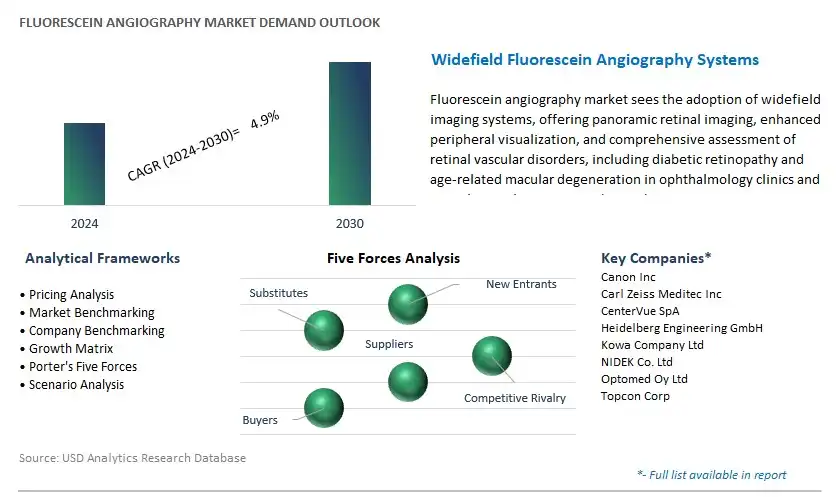 Fluorescein Angiography Industry- Market Size, Share, Trends, Growth Outlook